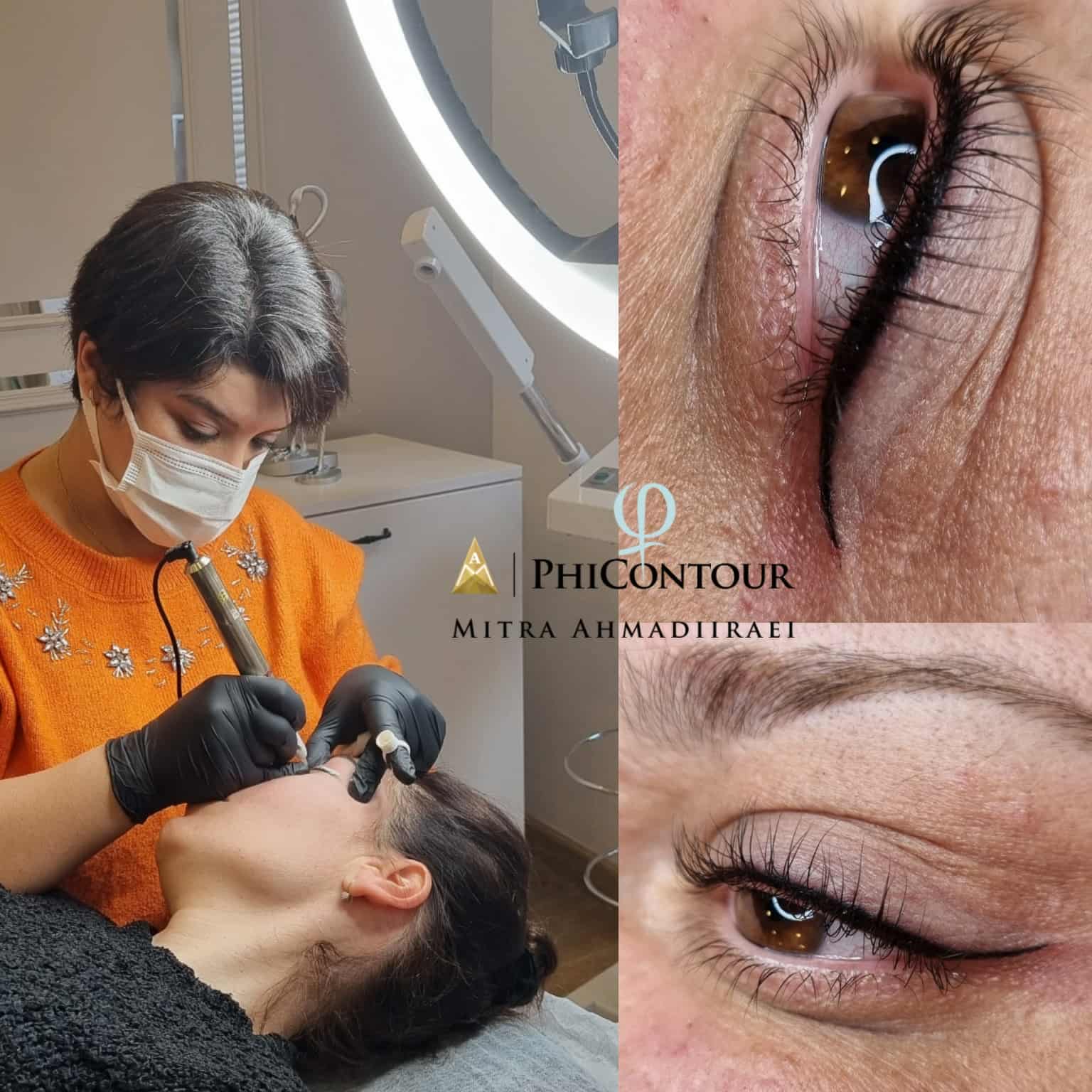 6B2B261D 90E8 4E30 Bf71 A6A0D014D58B | Bare Elegance Aesthetics Med Spa In San Diego