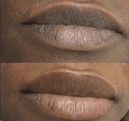 Screenshot 2025 11 26 114716 | Bare Elegance Aesthetics Med Spa In San Diego